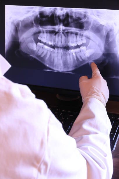 Best Emergency Cosmetic Dentistry (e.g., broken veneers) in Bingham Farms, MI
