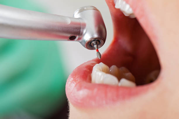 Best Walk-In Emergency Dental Services in Bingham Farms, MI